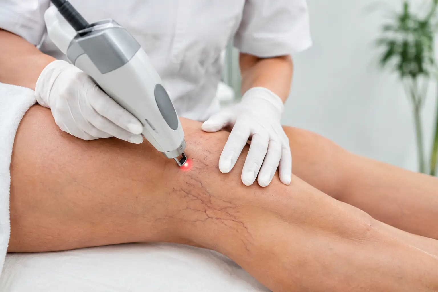 Laser Vein Removal Results and What to Expect