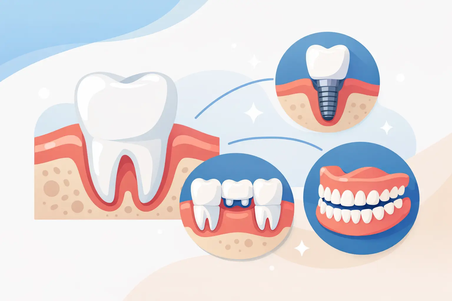 Best Tooth Replacement Options Explained