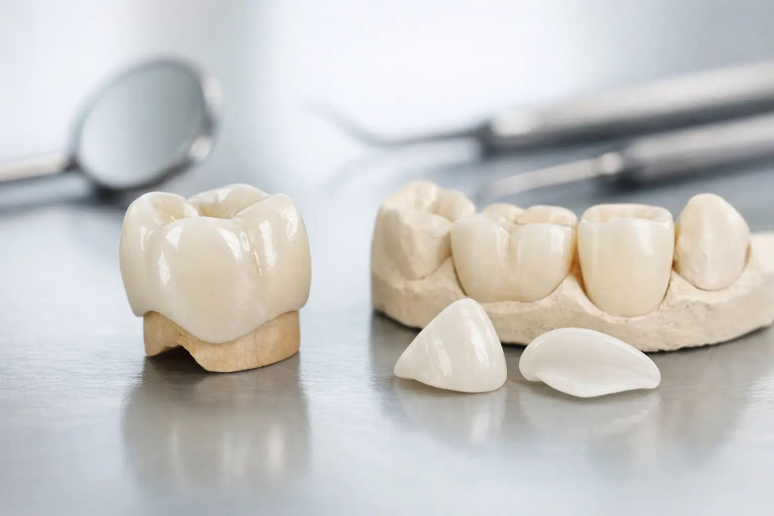 Crowns Versus Veneers: Which Is Right for You?