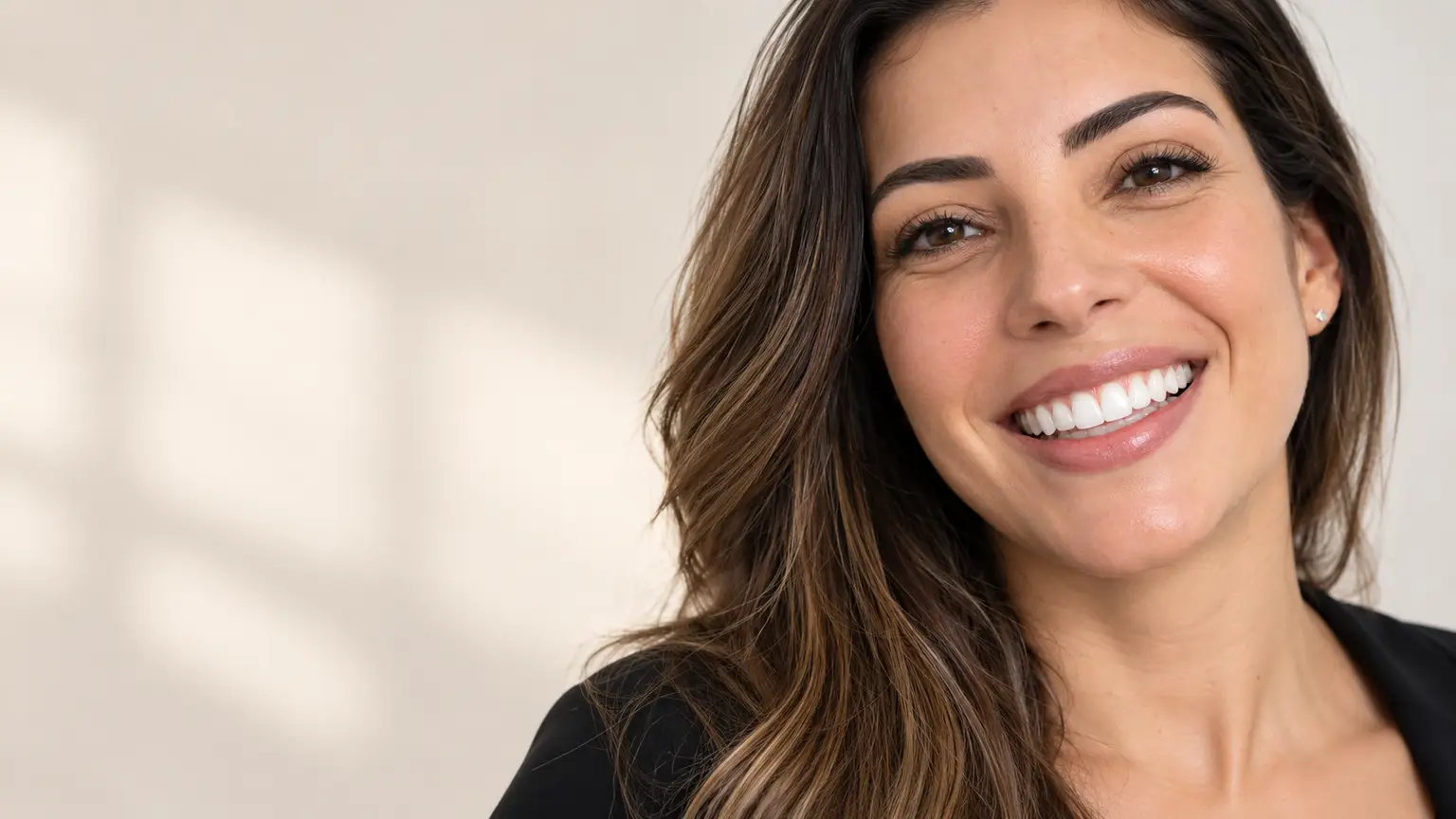 Lentes dentárias: critérios para casos previsíveis