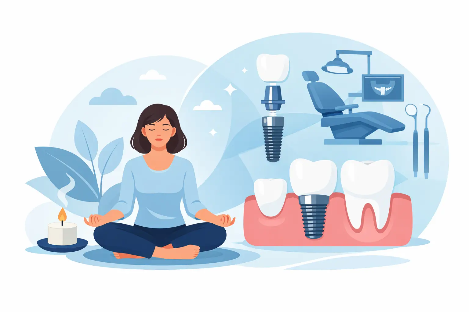 How to Prepare for Dental Implants Calmly