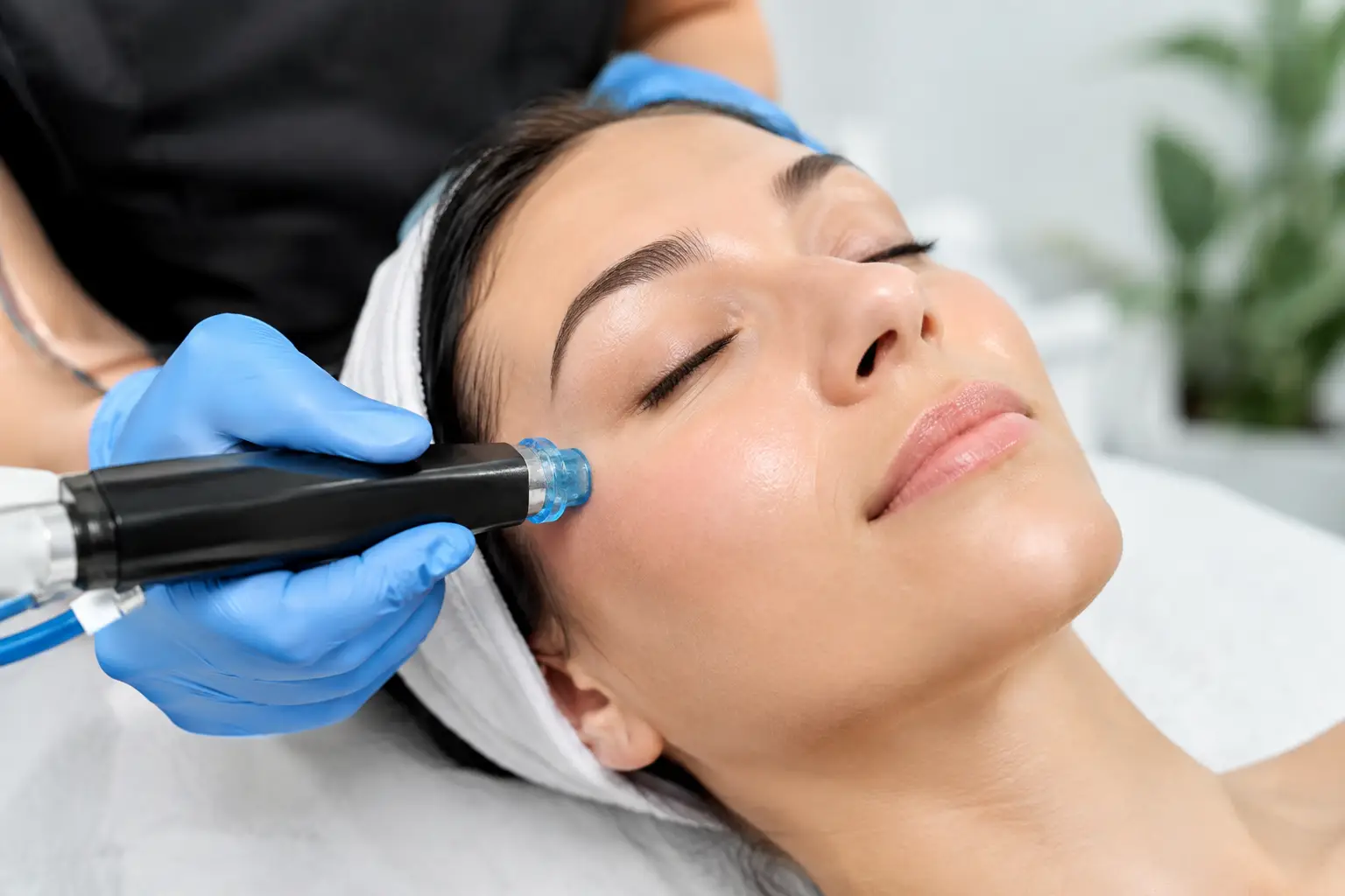 Can DiamondGlow Remove Blackheads? What to Expect